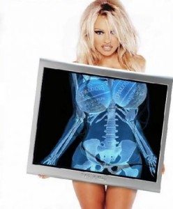 Pamela Anderson X-Ray